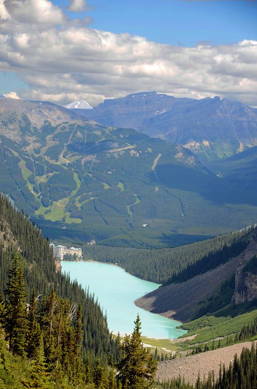 16 Lake Louise, Chateau Lake Louise, Mount Whitehorn and Redoubt Mountain From Junction Of Lake Agnes And Plain Of Six Glaciers Trails Near Lake Louise